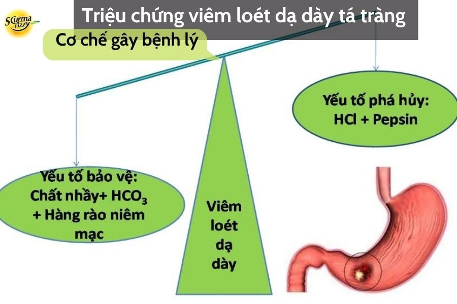 Yếu tố tác đông đến dạ dày
