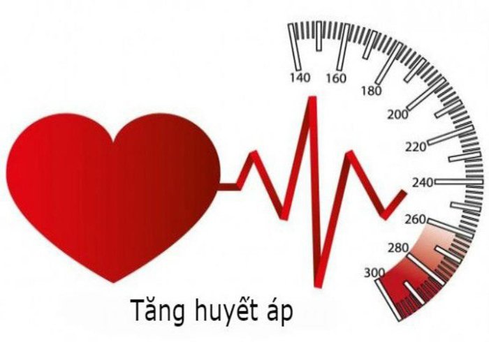 Tăng huyết áp: Nguyên nhân, triệu chứng, biến chứng, chẩn đoán và cách phòng ngừa